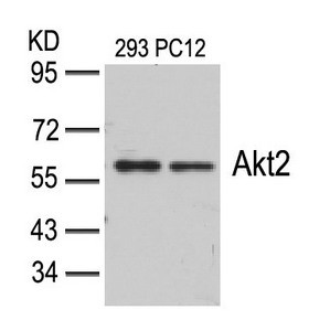 Anti-AKT2 (Ab-474)