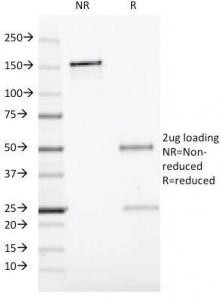 Anti-CD19 / B-lymphocyte marker, clone CVID3/429