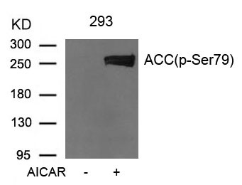 Anti-phospho-Acetyl-CoA Carboxylase (Ser79)