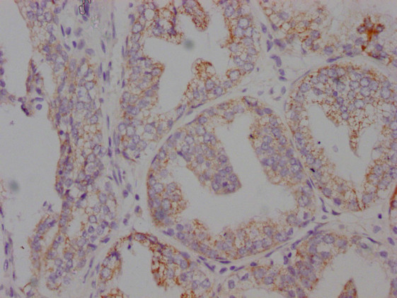 Anti-AMACR Monoclonal