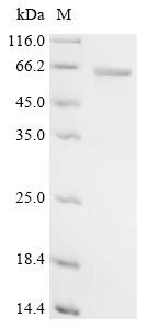 RAC-alpha serine/threonine-protein kinase (Akt1), rat, recombinant