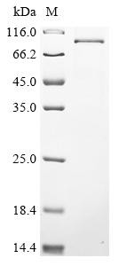 DNA polymerase theta (POLQ), partial, human, recombinant