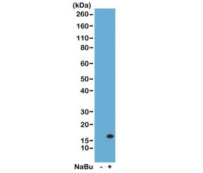 Anti-H3K14ac / Acetyl Histone H3 Lysine 14, clone RM130 (recombinant antibody)