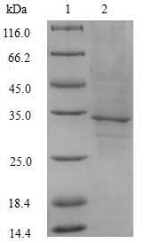 Fms-related tyrosine kinase 3 ligand (FLT3LG), partial, human, recombinant