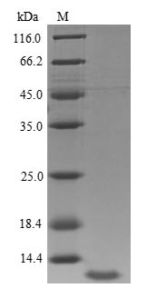 Insulin-like growth factor I (IGF1), human, recombinant