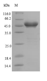 Glutathione S-transferase kappa 1 (GSTK1), partial (Active), human, recombinant