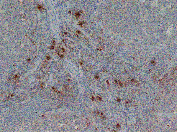 Anti-Mast Cell Tryptase, clone AA1