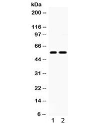 Anti-5HT2B Receptor