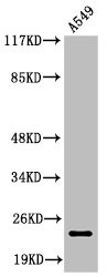 Anti-Cleaved-PARP1 (D214)