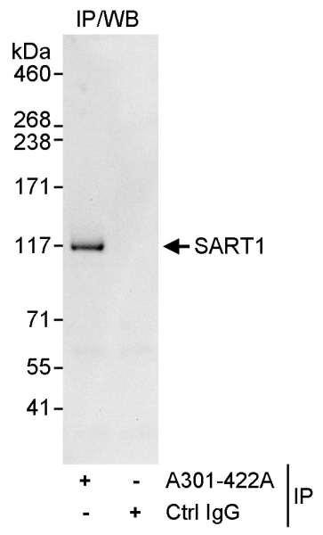 Anti-SART1