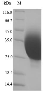 Metallothionein-1X (MT1X), partial, human, recombinant