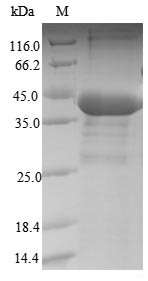 Serine/threonine-protein phosphatase PP1-beta catalytic subunit (PPP1CB), human, recombinant