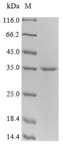 Cytotoxic T-lymphocyte protein 4 (Ctla4), partial, mouse, recombinant