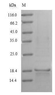 CD70 antigen (CD70), partial, human, recombinant