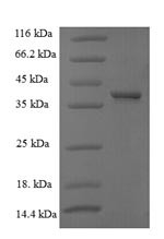 G1/S-specific cyclin-D1 (CCND1), human, recombinant