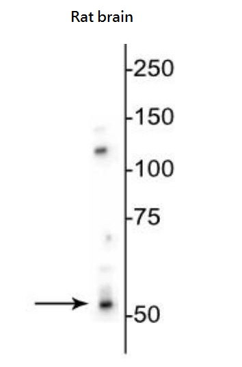 Anti-GABAA Receptor beta 3