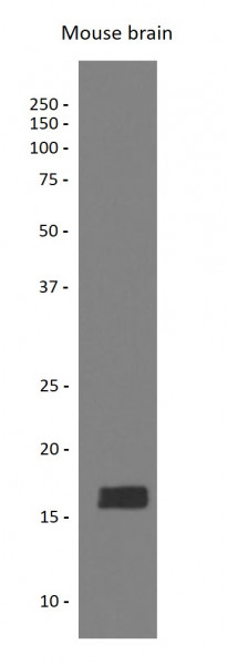 Anti-alpha+beta Synuclein