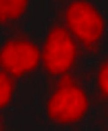 Anti-trimethyl-Histone H3 (Lys36)