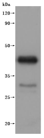 B-lymphocyte antigen CD20 (MS4A1)-VLPs (Active), dog, recombinant