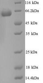 Glucose-6-phosphate isomerase (Gpi), mouse, recombinant