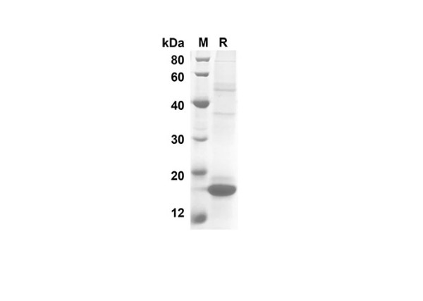 IL10 Protein (His Tag) (recombinant human)