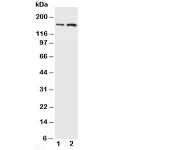 Anti-NMDAR2B