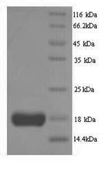 Interleukin-2 (IL2), human, recombinant