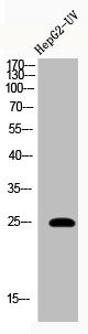 Anti-Acetyl-HMGB1 (K12)