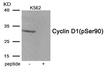 Anti-Phospho-CCND1 (Ser90)