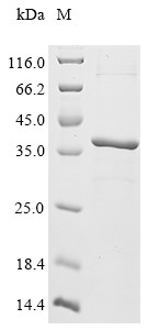 Deoxyribonuclease gamma (Dnase1l3), mouse, recombinant