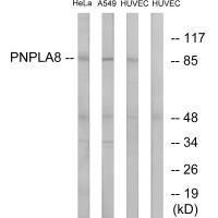 Anti-PNPLA8