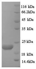 Caspase-8 (CASP8), partial, human, recombinant