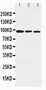 Anti-Anti-AHR Antibody