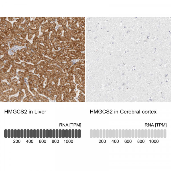 Anti-HMGCS2