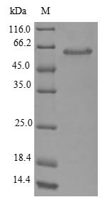 Glutaminase 1 (glsA1), Escherichia coli, recombinant