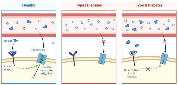 Diabetes_Figure_2_new