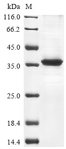 Deoxyribonuclease gamma (DNASE1L3), human, recombinant