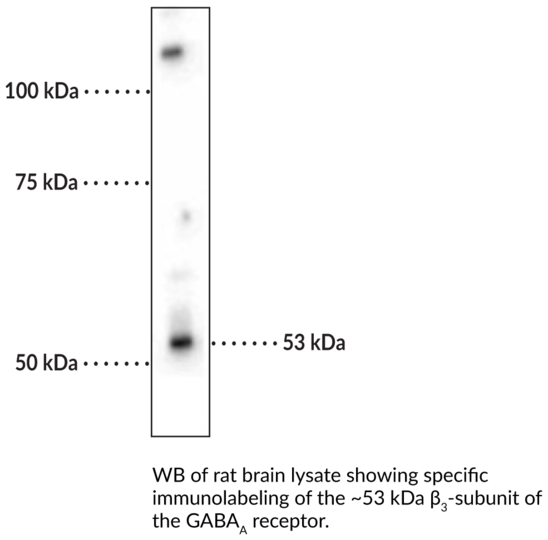 Anti-GABAA Receptor beta3 Subunit