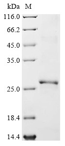 Hypoxanthine-guanine phosphoribosyltransferase (HPRT1), human, recombinant