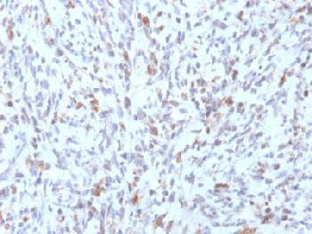 Anti-MyoD1 (Rhabdomyosarcoma Marker) Recombinant Mouse Monoclonal Antibody (clone:rMYD712)