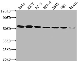 Anti-KLF4 Recombinant Monoclonal, clone 3A1