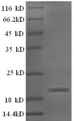 Interferon gamma (IFNG), sheep, recombinant