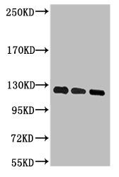 Anti-PARP1 Monoclonal