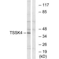 Anti-TSSK4