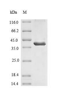 Signal-regulatory protein beta-1 (SIRPB1), partial, human, recombinant