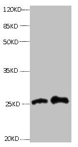 Anti-RBP4 Monoclonal, clone 6A1C2