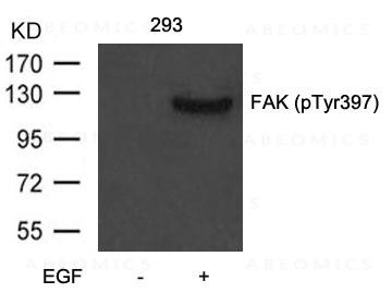 Anti-phospho-FAK (Tyr397)