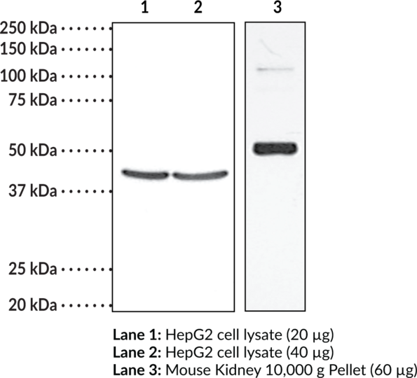 Anti-TP Receptor (human)