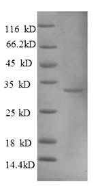 Metallothionein-1A (MT1A), partial, human, recombinant