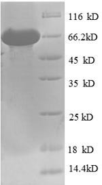 Bile acid receptor (NR1H4), human, recombinant